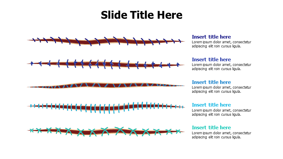 5 types of surgical stitches infographic