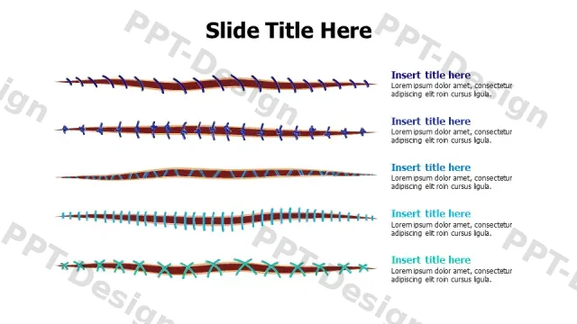 Five Surgical Suture Types Visual Guide | Free PPT Template
